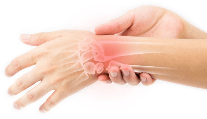 Maladies des articulations, du cartilage et des ligaments - indications pour l'utilisation de Hondrocream