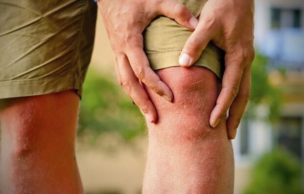 Image clinique de l'arthrose