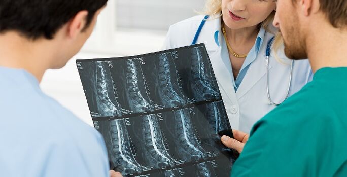 Radiographie de la colonne vertébrale utilisée pour diagnostiquer l'ostéochondrose