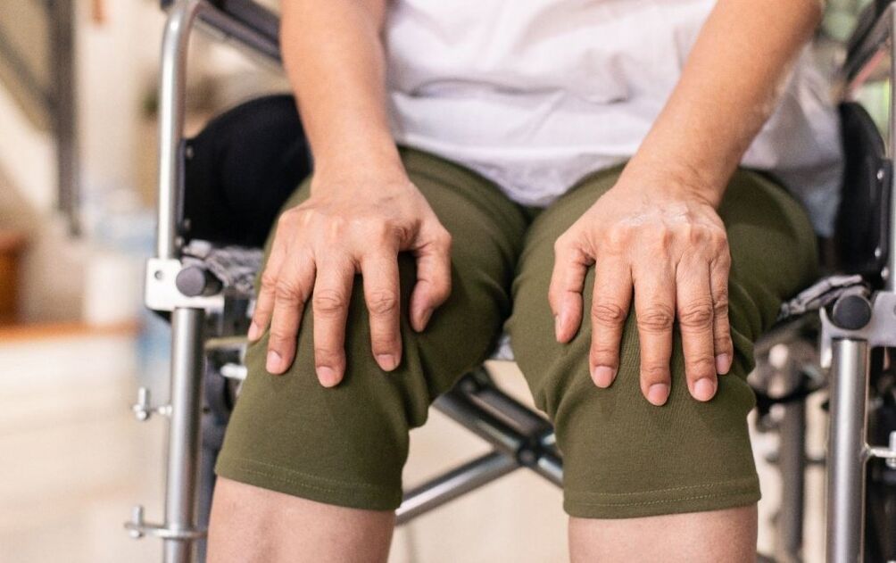 Un patient souffrant d'arthrose des articulations du genou