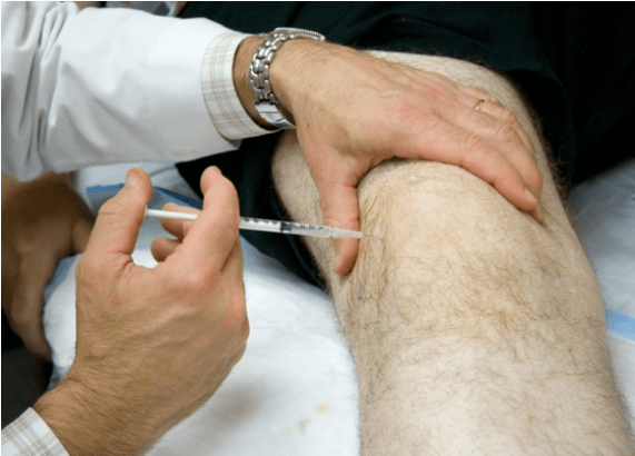 Administration intra-karticulaire d'analgésiques dans une douleur intense